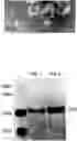 Fig. 01 - Purified Enriched Population Exosomes Derived From Individuals With A Chronic Progressive Lung Disease For Noninvasive Detection, Staging, And Medical Monitoring Of Disease Progression