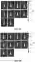Fig. 05 - Purified Enriched Population Exosomes Derived From Individuals With A Chronic Progressive Lung Disease For Noninvasive Detection, Staging, And Medical Monitoring Of Disease Progression