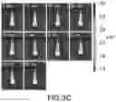 Fig. 06 - Purified Enriched Population Exosomes Derived From Individuals With A Chronic Progressive Lung Disease For Noninvasive Detection, Staging, And Medical Monitoring Of Disease Progression