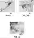 Fig. 07 - Purified Enriched Population Exosomes Derived From Individuals With A Chronic Progressive Lung Disease For Noninvasive Detection, Staging, And Medical Monitoring Of Disease Progression