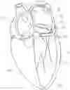 Fig. 01 - DEVICE, SYSTEM, AND METHOD FOR TRANSCATHETER TREATMENT OF VALVULAR REGURGITATION