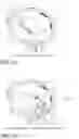 Fig. 27 - DEVICE, SYSTEM, AND METHOD FOR TRANSCATHETER TREATMENT OF VALVULAR REGURGITATION