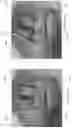Fig. 37 - DEVICE, SYSTEM, AND METHOD FOR TRANSCATHETER TREATMENT OF VALVULAR REGURGITATION
