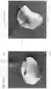 Fig. 40 - DEVICE, SYSTEM, AND METHOD FOR TRANSCATHETER TREATMENT OF VALVULAR REGURGITATION