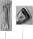 Fig. 42 - DEVICE, SYSTEM, AND METHOD FOR TRANSCATHETER TREATMENT OF VALVULAR REGURGITATION