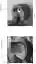 Fig. 43 - DEVICE, SYSTEM, AND METHOD FOR TRANSCATHETER TREATMENT OF VALVULAR REGURGITATION