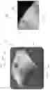 Fig. 44 - DEVICE, SYSTEM, AND METHOD FOR TRANSCATHETER TREATMENT OF VALVULAR REGURGITATION