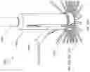 Fig. 50 - DEVICE, SYSTEM, AND METHOD FOR TRANSCATHETER TREATMENT OF VALVULAR REGURGITATION