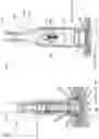 Fig. 51 - DEVICE, SYSTEM, AND METHOD FOR TRANSCATHETER TREATMENT OF VALVULAR REGURGITATION