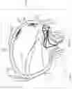 Fig. 74 - DEVICE, SYSTEM, AND METHOD FOR TRANSCATHETER TREATMENT OF VALVULAR REGURGITATION