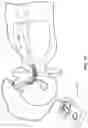 Fig. 05 - INTERNAL ULTRAVIOLET THERAPY