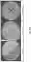 Fig. 52 - INTERNAL ULTRAVIOLET THERAPY