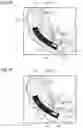 Fig. 19 - MEDICAL SYSTEM AND CANNULATION METHOD