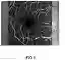 Fig. 06 - SYSTEMS AND METHODS TO MEASURE RETINAL PERFUSION