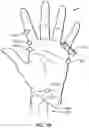 Fig. 09 - Apparatus for anatomic three dimensional scanning and automated three dimensional cast and splint design