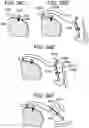 Fig. 75 - Soft tissue fixation repair methods using tissue augmentation constructs