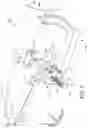 Fig. 02 - METHODS AND APPARATUS FOR MINIMALLY INVASIVE BUNION SURGERY