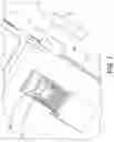 Fig. 09 - METHODS AND APPARATUS FOR MINIMALLY INVASIVE BUNION SURGERY