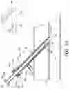Fig. 16 - NEEDLE AND CANNULA ASSEMBLY FOR CANNULATION AND TREATMENT OF SUBCUTANEOUS VESSELS