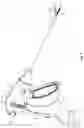 Fig. 02 - VESSEL SEALER WITH PLASMA BLADE DISSECTION ELECTRODE