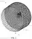 Fig. 03 - DEVICE FOR OCCLUSION OF A LEFT ATRIAL APPENDAGE OF A HEART
