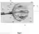 Fig. 09 - SYSTEMS AND METHOD OR USES OF ABLATING CARDIAC TISSUE