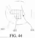 Fig. 23 - Hair removing device