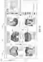 Fig. 07 - Systems and methods for surgical planning based on bone density
