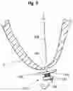 Fig. 06 - Epicardial anchor devices and methods