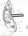 Fig. 26 - Epicardial anchor devices and methods