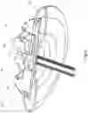 Fig. 28 - Epicardial anchor devices and methods