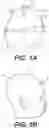 Fig. 02 - CRANIAL REMOLDING ORTHOSIS DEVICE, SYSTEMS, AND METHODS THEREOF