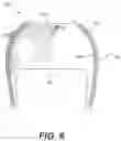 Fig. 07 - CRANIAL REMOLDING ORTHOSIS DEVICE, SYSTEMS, AND METHODS THEREOF