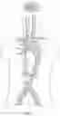 Fig. 02 - SELECTIVE PERFUSION DEVICE AND METHOD