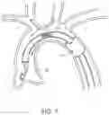 Fig. 08 - SELECTIVE PERFUSION DEVICE AND METHOD