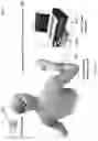 Fig. 02 - Flexible Sheet for Neuromuscular Stimulation