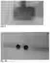 Fig. 09 - Flexible Sheet for Neuromuscular Stimulation