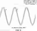 Fig. 08 - SYSTEMS AND METHODS FOR AUTOMATICALLY IDENTIFYING, ANALYZING AND REDUCING EXTRANEOUS WAVEFORM CAPTURES