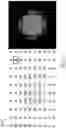 Fig. 06 - Data processing method for rapidly suppressing high-frequency background noise in a digitized image
