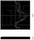 Fig. 03 - METHOD AND SYSTEM FOR DATA EXTRACTION FROM ECHOCARDIOGRAPHIC STRAIN GRAPHS