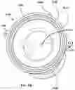 Fig. 07 - Natural orifice surgery system