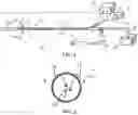 Fig. 02 - Balloon ablation catheter system and method of controlling same