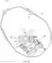 Fig. 07 - PIVOTING SURGICAL IMPLANT PLACEMENT TOOL