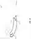 Fig. 09 - MOTION BASED DENTAL SPLINTS