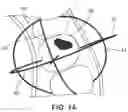 Fig. 12 - Generating 3D models of a patient's teeth based on 2D teeth images