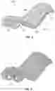 Fig. 02 - Palatal expanders for controlling crown tipping