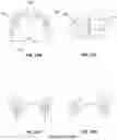 Fig. 09 - Palatal expanders for controlling crown tipping