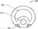 Fig. 01 - Feeding tube with electromagnetic sensor