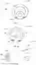 Fig. 02 - Feeding tube with electromagnetic sensor