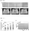 Fig. 11 - HYBRID STRUCTURE, MANUFACTURING METHOD FOR THE SAME, AND FOG CAPTURE INCLUDING THE SAME